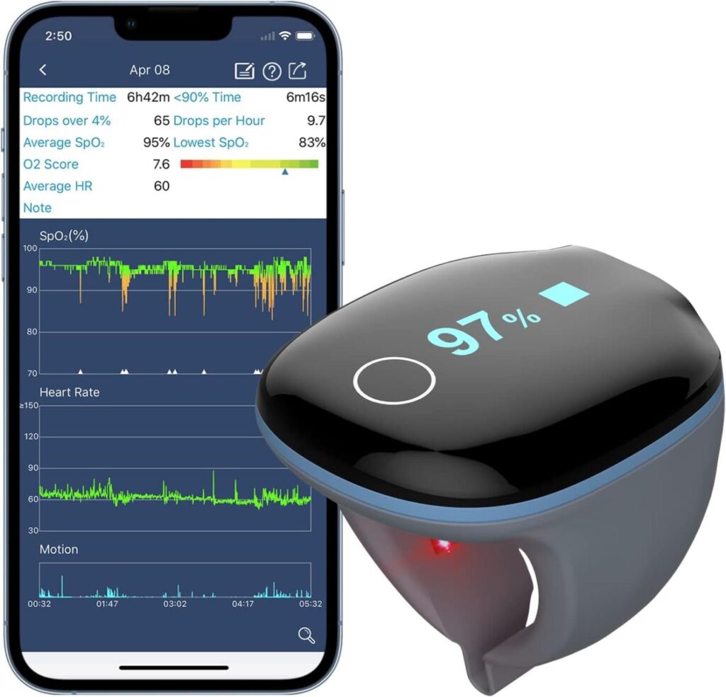 Sleep Monitor