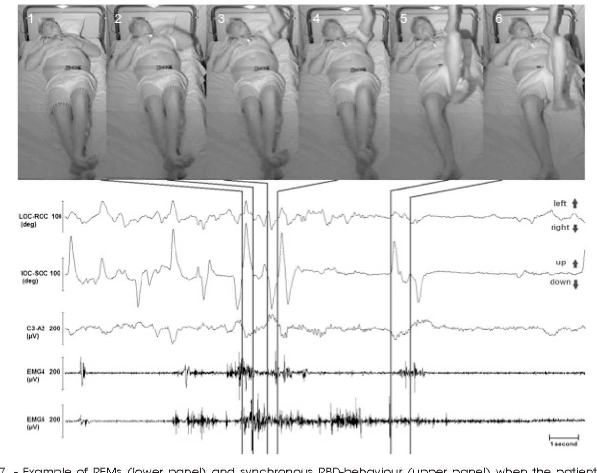 Figure 1 from The 'scanning hypothesis' of rapid eye movements during ...